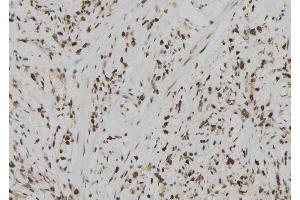 ABIN6273024 at 1/100 staining Human gastric tissue by IHC-P. (USP39 Antikörper  (N-Term))