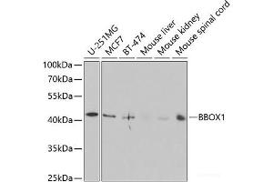 Western blot analysis of extracts of various cell lines using BBOX1 Polyclonal Antibody at dilution of 1:1000. (BBOX1 Antikörper)