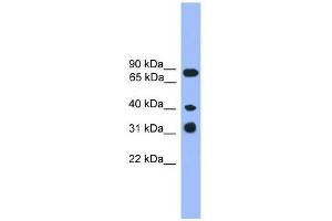 Western Blot showing LAX1 antibody used at a concentration of 1-2 ug/ml to detect its target protein. (LAX1 Antikörper  (C-Term))