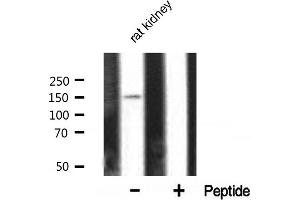 Western blot analysis of PLCG1 expression in rat kidney tissue lysates,The lane on the right is treated with the antigen-specific peptide. (Phospholipase C gamma 1 Antikörper)