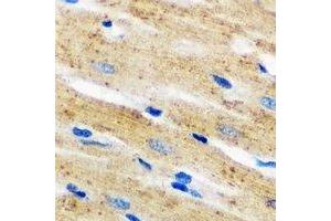 Immunohistochemical analysis of p67 phox staining in mouse heart formalin fixed paraffin embedded tissue section. (NCF2 Antikörper)