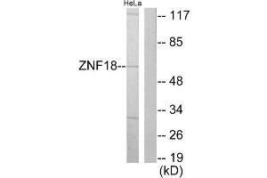 Western Blotting (WB) image for anti-Zinc Finger Protein 18 (ZNF18) (Internal Region) antibody (ABIN1849191) (ZNF18 Antikörper  (Internal Region))
