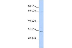 WB Suggested Anti-REL Antibody Titration:  0.