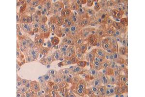 Used in DAB staining on fromalin fixed paraffin- embedded Kidney tissue (LYPLA1 Antikörper  (AA 1-230))