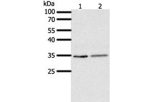 Western Blot analysis of Human fetal lung tissue and A549 cell using SFTPA1 Polyclonal Antibody at dilution of 1:300 (Surfactant Protein A1 Antikörper)