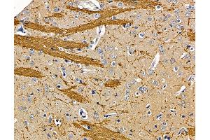 ABIN7095927 and ABIN7099989 at 1/100 staining rat brain tissue by IHC-P.