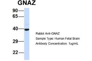 Host:  Rabbit  Target Name:  GNAZ  Sample Type:  Human Fetal Brain  Antibody Dilution:  1. (GNaZ Antikörper  (N-Term))