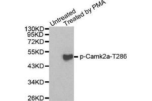 Western blot analysis of extracts from 293 cells using Phospho-Camk2a-T286 antibody. (CAMK2A Antikörper  (pThr286))