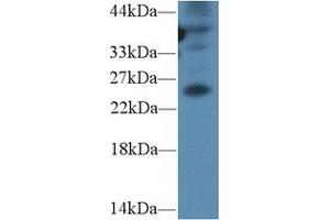 Detection of GREM1 in Mouse Spleen lysate using Polyclonal Antibody to Gremlin 1 (GREM1) (GREM1 Antikörper  (AA 25-184))