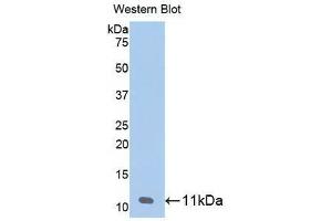 Western blot analysis of the recombinant protein. (beta-Thromboglobulin Antikörper  (AA 59-128))