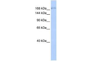 WB Suggested Anti-SUPT6H Antibody Titration: 0. (Spt6 Antikörper  (N-Term))