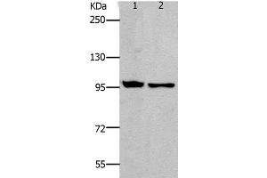 Western Blot analysis of HT-29 and SKOV3 cell using NFκB-p100 Polyclonal Antibody at dilution of 1:800 (NFKB2 Antikörper)
