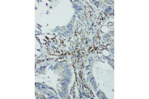 Immunohistochemistry (IHC) image for anti-Eukaryotic Translation Initiation Factor 6 (EIF6) (AA 82-96), (Middle Region) antibody (ABIN3044059)