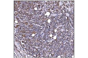IHC analysis of LILRB1 using anti-LILRB1 antibody (ABIN7601409).