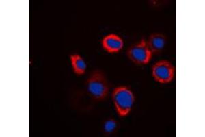 Immunofluorescent analysis of Renin Receptor staining in Raw264. (ATP6AP2 Antikörper  (Center))