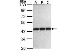 WB Image Sample (30 ug of whole cell lysate) A: 293T B: A431 , C: H1299 10% SDS PAGE antibody diluted at 1:1000 (PGK1 Antikörper)
