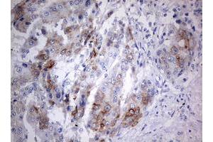Immunohistochemistry (IHC) image for anti-Chromosome 3 Open Reading Frame 15 (C3orf15) (AA 1-313) antibody (ABIN2715591) (C3orf15 Antikörper  (AA 1-313))