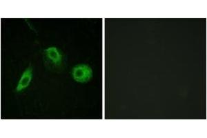Immunofluorescence analysis of HeLa cells, using PLCG2 (Phospho-Tyr1217) Antibody. (Phospholipase C gamma 2 Antikörper  (pTyr1217))