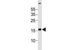 Western blot analysis of lysate from human brain tissue using LC3A antibody diluted at 1:1000.