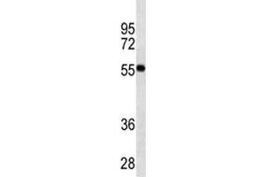 VDR antibody western blot analysis in MDA-MB453 lysate. (Vitamin D Receptor Antikörper)