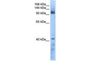 Image no. 1 for anti-RecQ Protein-Like 5 (RECQL5) (AA 431-480) antibody (ABIN6736603) (RECQL5 Antikörper  (AA 431-480))