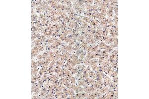 Immunohistochemical analysis of paraffin-embedded human liver tissue using (ABIN388518 and ABIN2849631) performed on the Leica® BOND RXm. (ATG5 Antikörper  (N-Term))