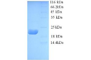 Interleukin 10 (IL10) (AA 20-177), (full length) protein (His tag)