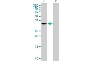 Western Blot analysis of CAPZA2 expression in transfected 293T cell line by CAPZA2 MaxPab polyclonal antibody. (CAPZA2 Antikörper  (AA 1-286))