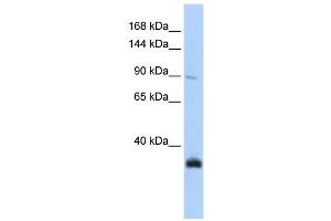 MORC3 antibody used at 1 ug/ml to detect target protein. (MORC3 Antikörper  (N-Term))