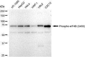 Western blotting analysis using Phospho-eIF4B (S406) antibody (ABIN7798527).