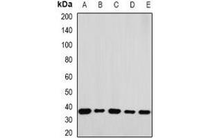 Western blot analysis of RPLP0 expression in A549 (A), K562 (B), Jurkat (C), mouse liver (D), mouse testis (E) whole cell lysates. (RPLP0 Antikörper)