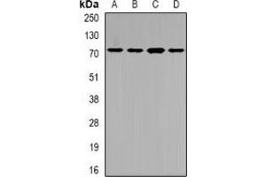 Western blot analysis of SLC22A11 expression in SW620 (A), HepG2 (B), mouse liver (C), rat kidney (D) whole cell lysates. (SLC22A11 Antikörper)