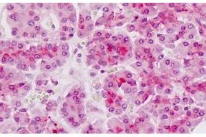 Immunohistochemistry (IHC) image for anti-Alveolar Soft Part Sarcoma Chromosome Region, Candidate 1 (ASPSCR1) (AA 392-418) antibody (ABIN1804342)