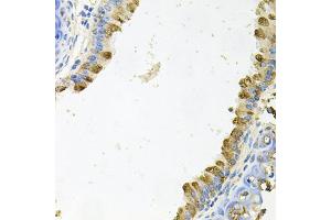 Immunohistochemistry of paraffin-embedded mouse lung using KLK11 antibody (ABIN5975048) at dilution of 1/100 (40x lens). (Kallikrein 11 Antikörper)