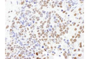 Immunohistochemistry (IHC) image for anti-Splicing Factor 1 (SF1) (AA 25-75) antibody (ABIN7453644) (Splicing Factor 1 Antikörper  (AA 25-75))