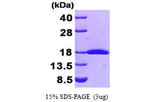 Fragile Histidine Triad (FHIT) (AA 1-147) protein (His tag)