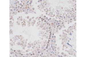 Immunohistochemistry of paraffin-embedded Mouse testis using KDM3A Polyclonal Antibody at dilution of 1:100 (40x lens). (KDM3A Antikörper)
