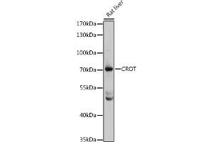 Western blot analysis of extracts of rat liver, using CROT antibody (ABIN1679365, ABIN3019208, ABIN3019209 and ABIN6220764) at 1:3000 dilution. (CROT Antikörper  (AA 1-87))
