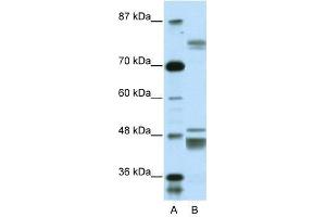 ZNF607 antibody used at 0. (ZNF607 Antikörper  (Middle Region))