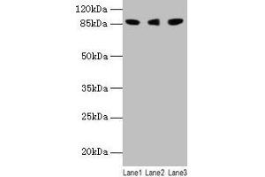 Western blot All lanes: Loxl2 antibody at 14 μg/mL Lane 1: 293T whole cell lysate Lane 2: A549 whole cell lysate Lane 3: A431 whole cell lysate Secondary Goat polyclonal to rabbit IgG at 1/10000 dilution Predicted band size: 88, 82 kDa Observed band size: 88 kDa (LOXL2 Antikörper  (AA 26-776))