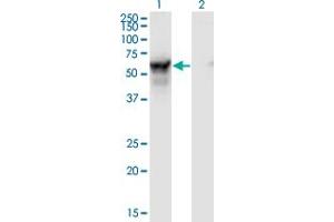 Western Blot analysis of NMT2 expression in transfected 293T cell line by NMT2 monoclonal antibody (M01), clone S1.