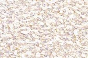 Immunohistochemistry analysis of paraffin-embedded rat placenta using,PTGFR (ABIN7075209) at dilution of 1: 800 (PTGFR Antikörper)