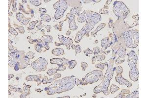 IHC analysis of ACKR2 using anti-ACKR2 antibody (ABIN6719286).