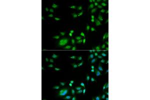 Immunofluorescence analysis of A549 cell using INTS10 antibody. (INTS10 Antikörper)