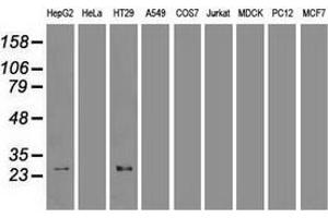 Western blot analysis of extracts (35 µg) from 9 different cell lines by using anti-HHex monoclonal antibody. (HHEX Antikörper  (AA 100-270))