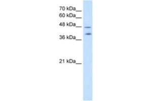 Western Blotting (WB) image for anti-Pregnancy Specific beta-1-Glycoprotein 1 (PSG1) antibody (ABIN2462567) (PSG1 Antikörper)