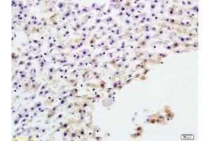 Formalin-fixed and paraffin embedded rat liver tissue labeled with Anti-AP-TNAP/ALP Polyclonal Antibody, Unconjugated  at 1:200 followed by conjugation to the secondary antibody and DAB staining