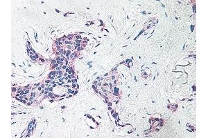 Image no. 6 for anti-Platelet Factor 4 (PF4) antibody (ABIN465152)