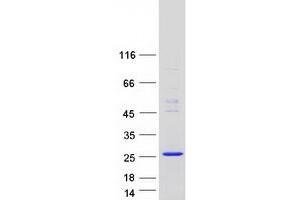 Validation with Western Blot (THEM6 Protein (Myc-DYKDDDDK Tag))