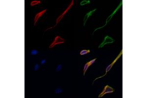 ABIN6257619 and ABIN6275298 staining Hela cells by IF/ICC.